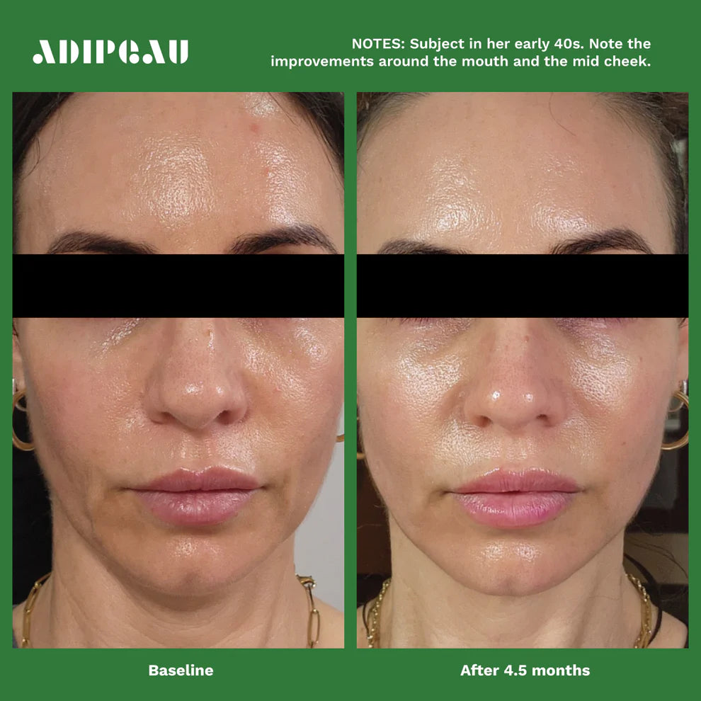 Adipeau Active Face Cream