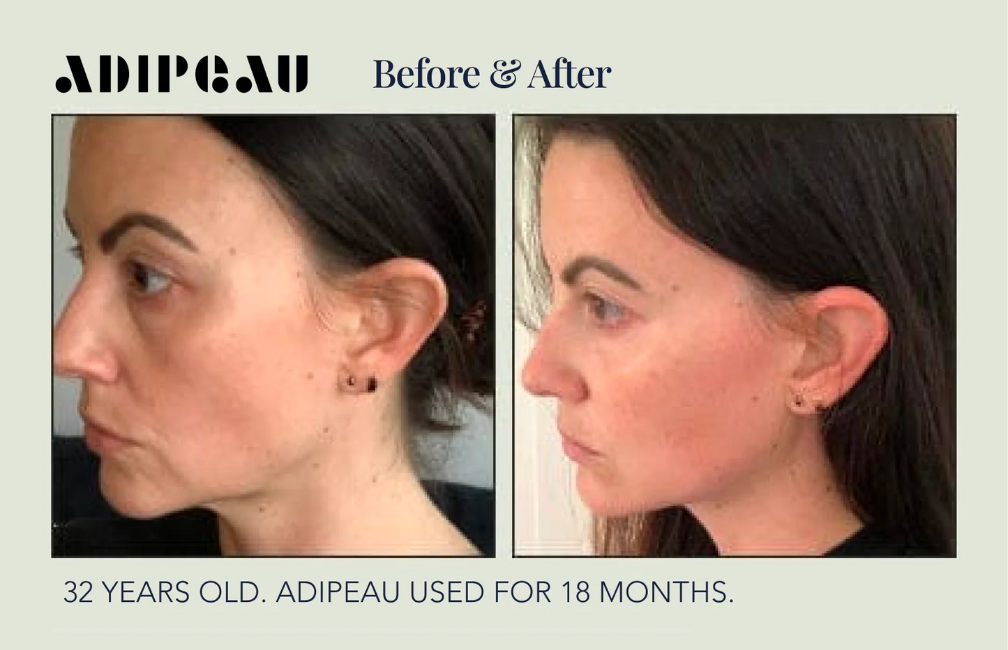 Adipeau Active Face Cream