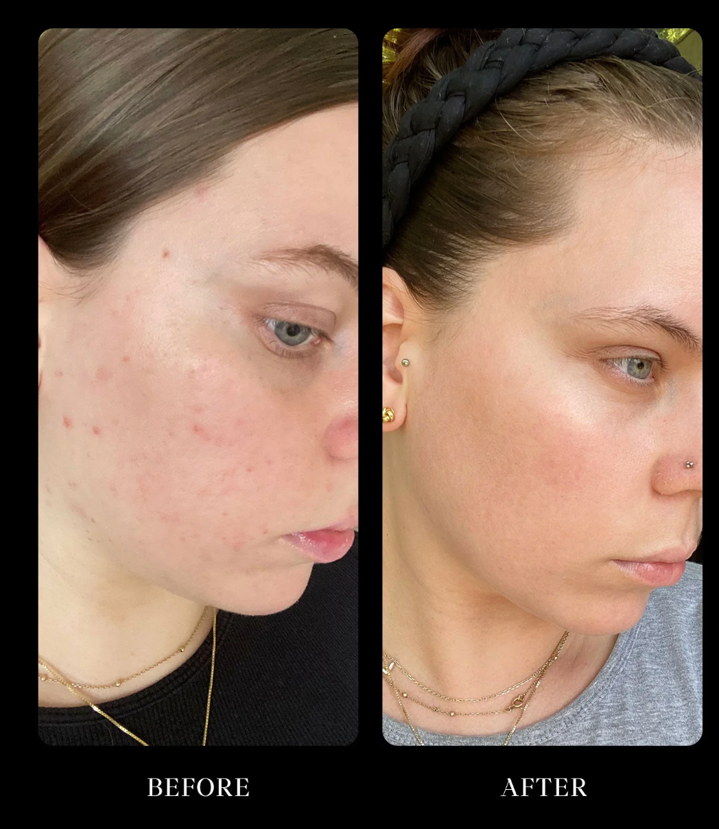 Beauty Renewal - Probiotic Concentrate