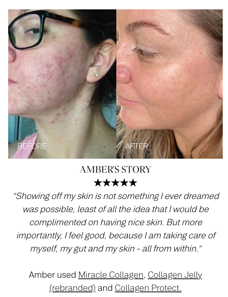 Beauty Renewal - Probiotic Concentrate