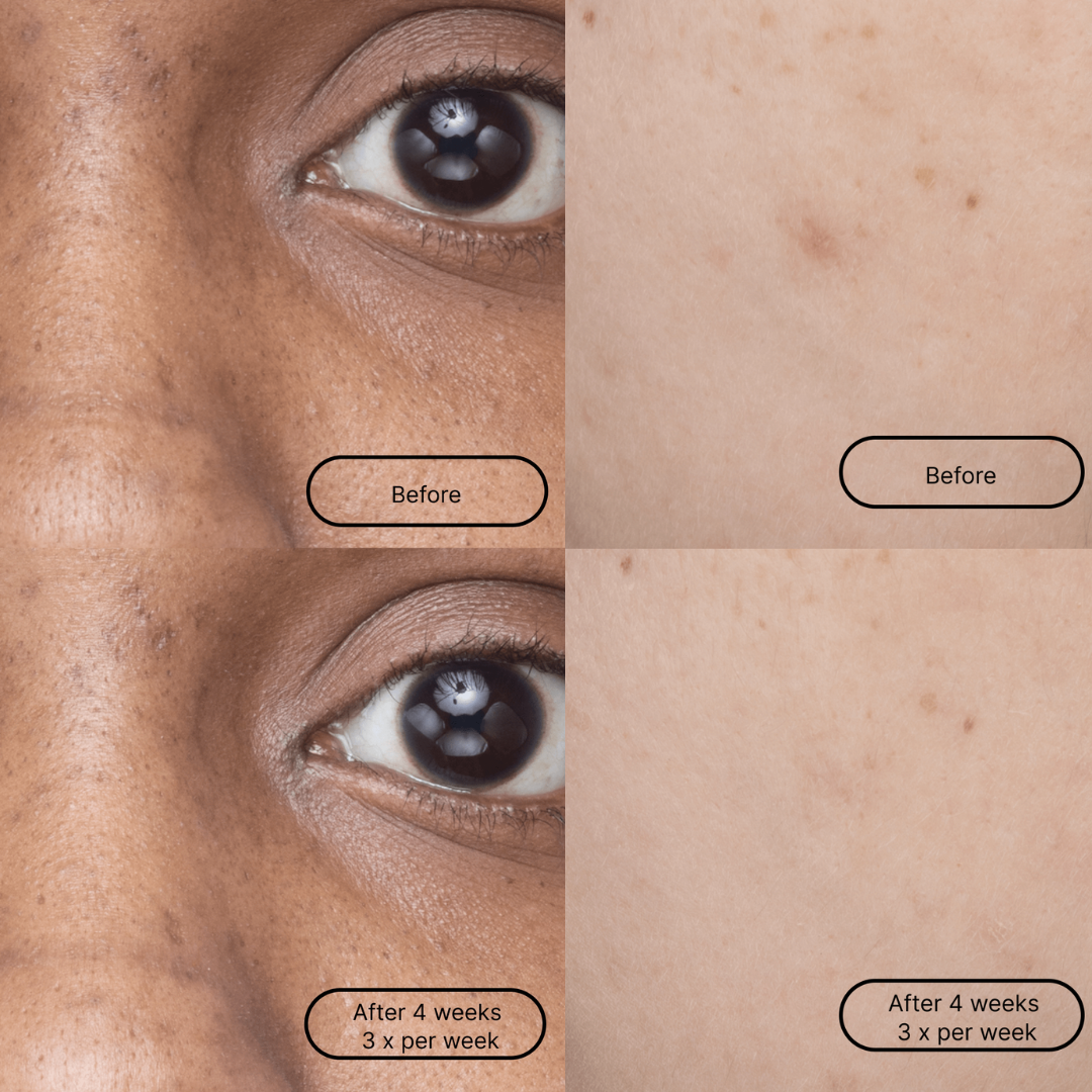 "Hyper Smooth" Sheet Mask