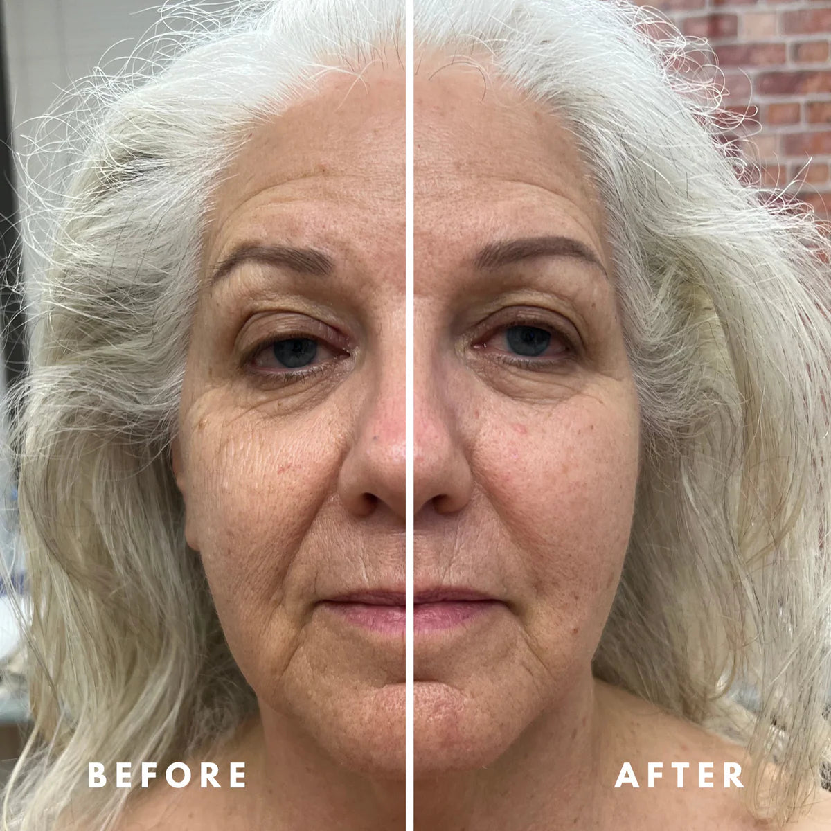 The Lymphatic Brush by Cecily Braden - Large & Small Combo Set