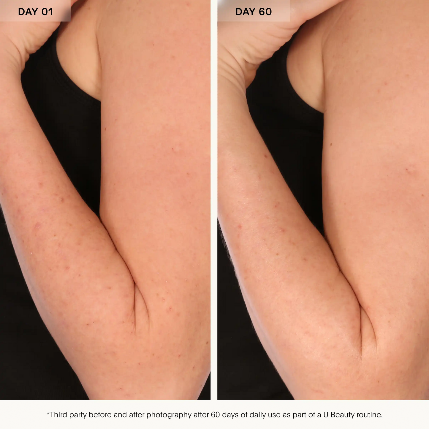 U Beauty Resurfacing BODY Compound