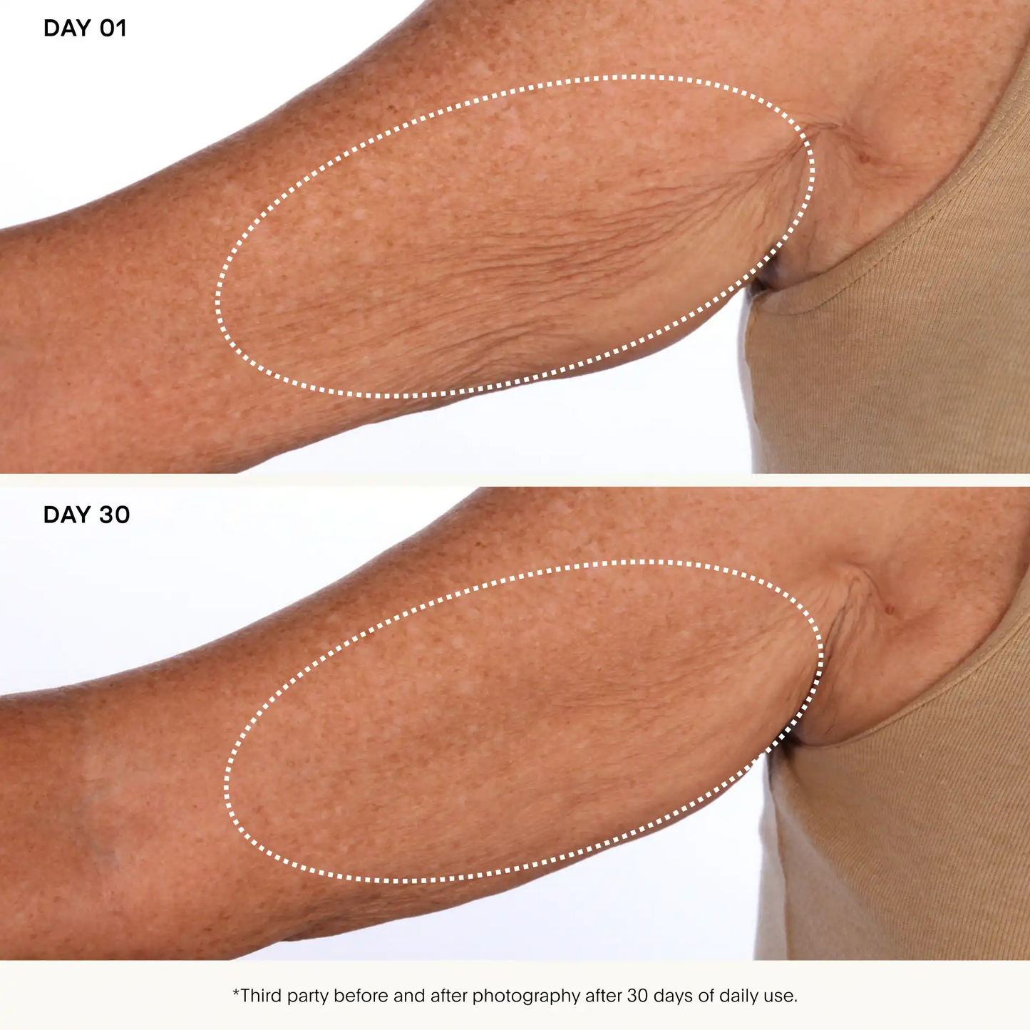 The SCULPT Arm Compound