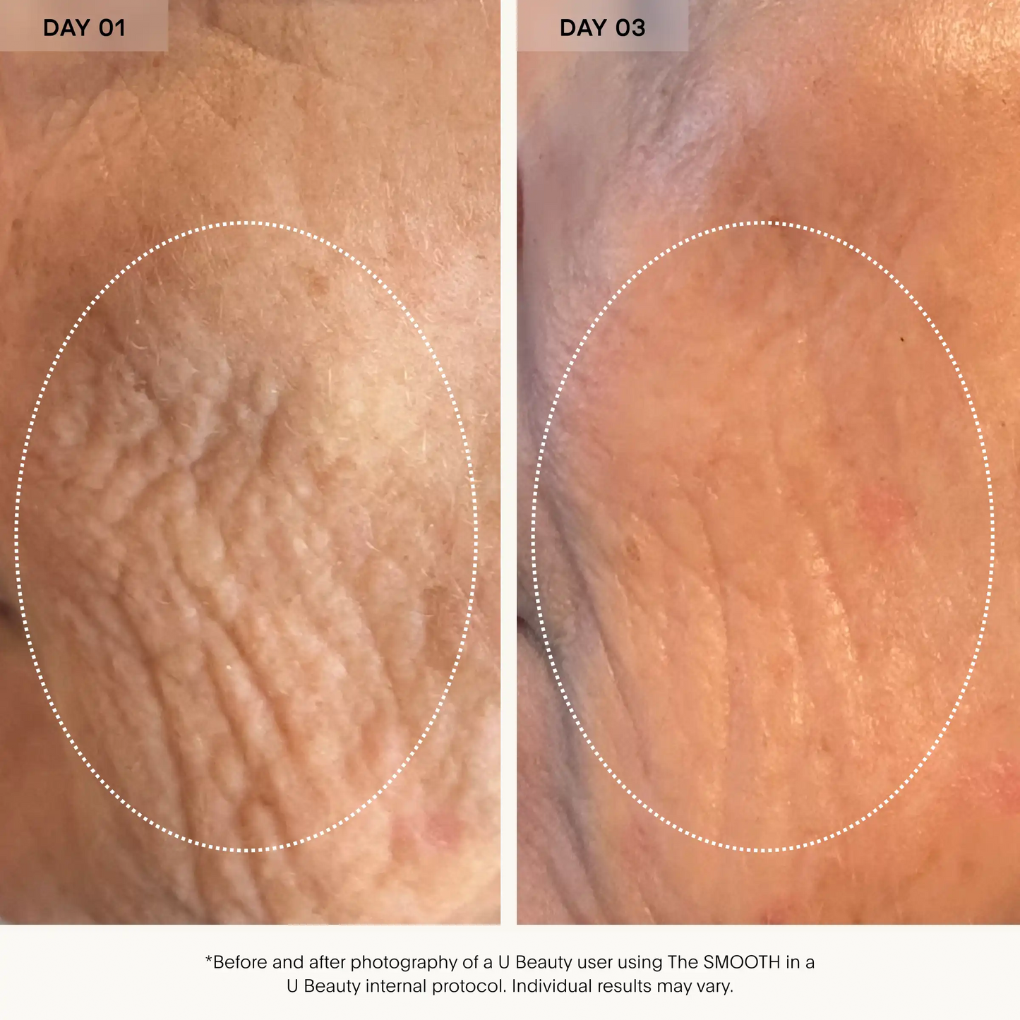 The Smooth Wrinkle Defense Serum